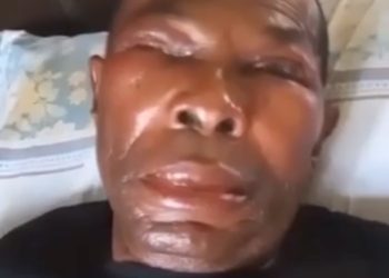 Pandemonium, As Angry Youths Bathe Joe Igbokwe’s Kinsman with Acid in Nnewi