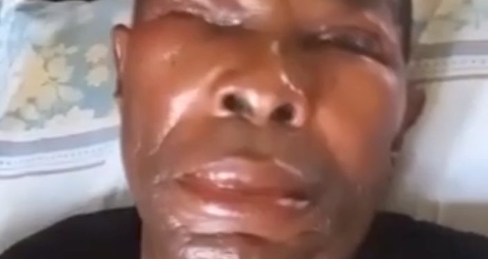 Pandemonium, As Angry Youths Bathe Joe Igbokwe’s Kinsman with Acid in Nnewi