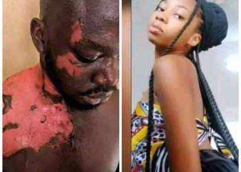 Tragic! UNIZIK Student Pours Hot Water on Hostel President