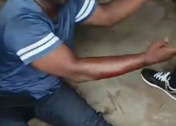 We Even Want You Dead — Anti-Tout Officials Tell Man with Pregnant Wife As They Brutalize Him in Anambra