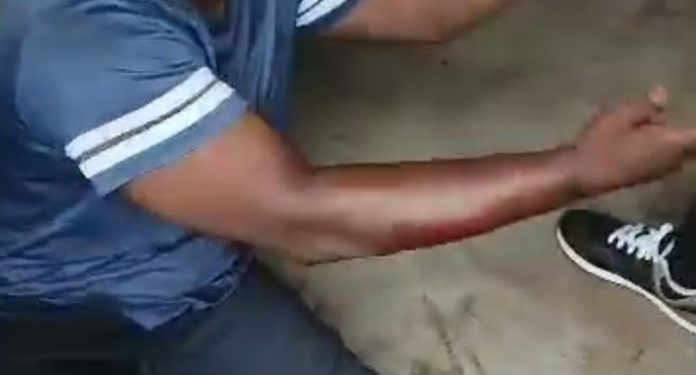 We Even Want You Dead — Anti-Tout Officials Tell Man with Pregnant Wife As They Brutalize Him in Anambra