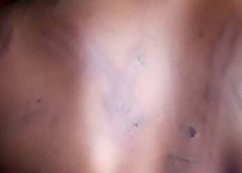 Widow agonizes as 3 vigilante operatives torture, rape teenage daughter in Anambra