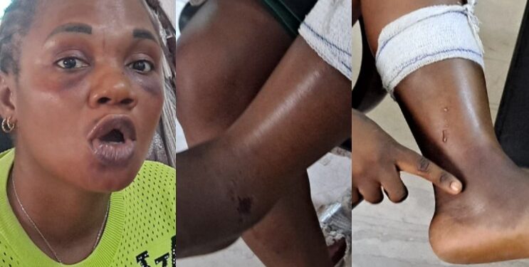 Man attempts crippling wife with pestle over minor misunderstanding