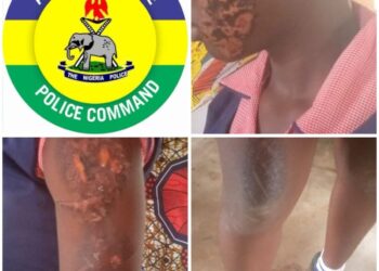 Anambra Police Arrest Guardian Over Alleged Brutal Abuse of 17-Year-Old House Help