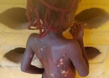 Anambra Woman Arrested Over torturing of 7-year-old daughter with hot knife