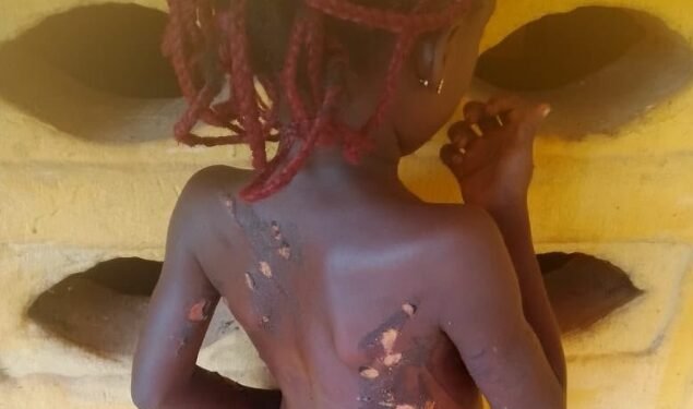 Anambra Woman Arrested Over torturing of 7-year-old daughter with hot knife
