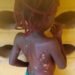 Anambra Woman Arrested Over torturing of 7-year-old daughter with hot knife