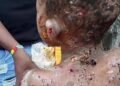 Anambra arraigns couple over severe physical harm to minor living with them