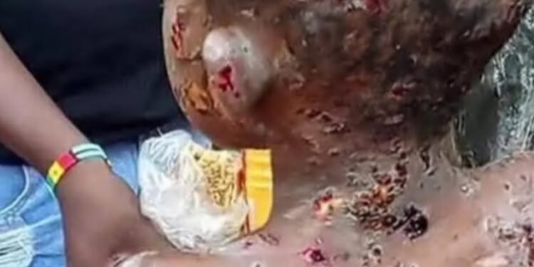 Anambra arraigns couple over severe physical harm to minor living with them