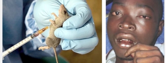 Just In: Lassa Fever Hits Anambra
